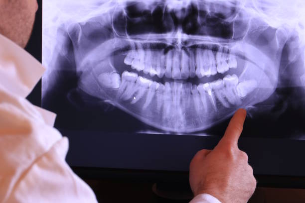 Best Emergency Root Canal Treatment in Knoxville, TN
