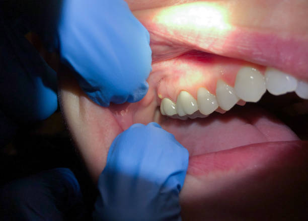 Best Mobile Emergency Dentist in Knoxville, TN