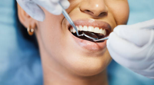 Best Broken or Cracked Tooth Emergency Dentist in Knoxville, TN
