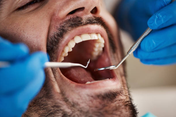 Best Emergency Dental Extractions in Knoxville, TN