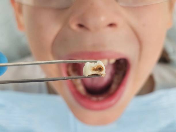 Best Emergency Dentist for Special Needs Patients in Knoxville, TN